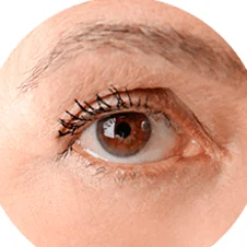 Contorno de ojos, semana 4